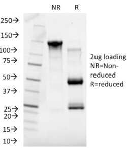 SHBG Antibody (SHBG/245), Novus Biologicals 0.2mg; Unlabeled:Antibodies,
